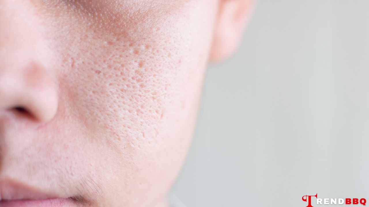 Causes of Large Pores