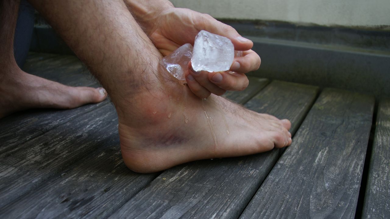 How to Treat a Sprained Ankle with Ice